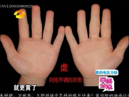 百科全说王晨霞细说女人病视频