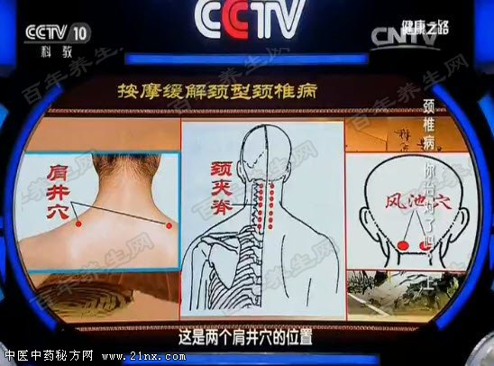 缓解颈型颈椎病的穴位