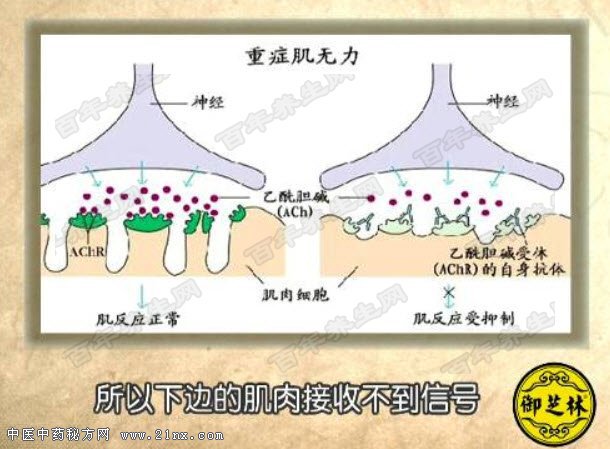 ÖØÖ¢¼¡ÎÞÁ¦µÄÔÒò
