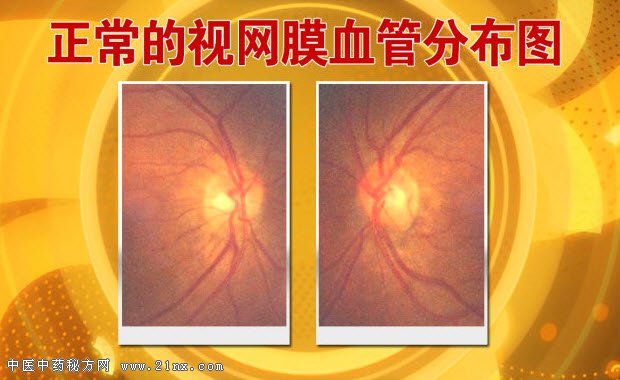 正常视网膜分布图