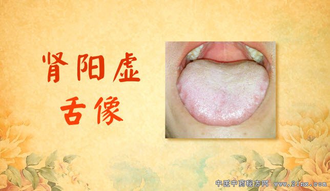 肾阳虚的舌像