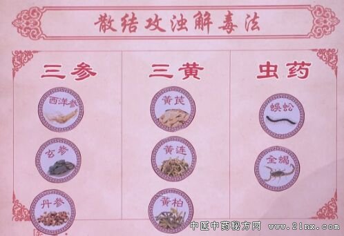 养生堂20180320《祛除人体第七邪-2》肿瘤日常调理方、散结攻浊解毒方 散结攻浊解毒方