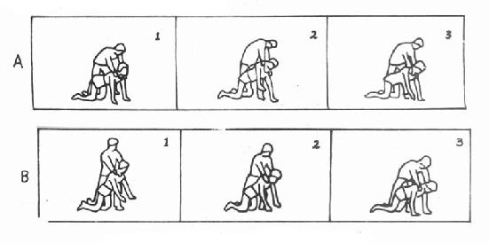 一侧(A)和两侧(B)的训练法