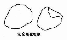 复层扁平(鳞状)上皮各层脱落细胞示意图