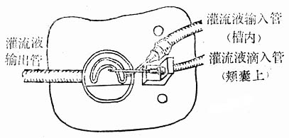 金黄 地鼠颊市灌流装置