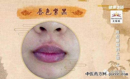 ֮·20180810:,Ѫ,Ѫ׻,