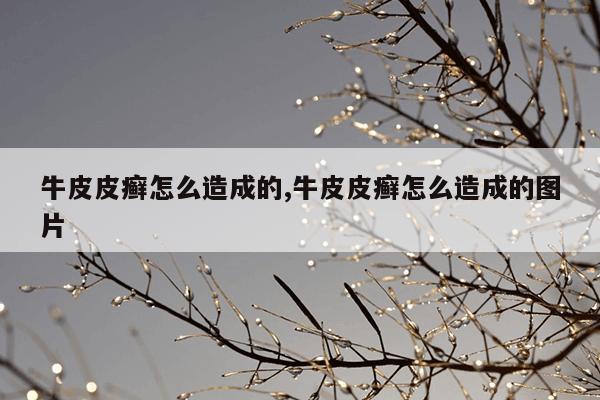 牛皮皮癣怎么造成的,牛皮皮癣怎么造成的图片