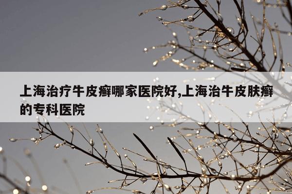 上海治疗牛皮癣哪家医院好,上海治牛皮肤癣的专科医院