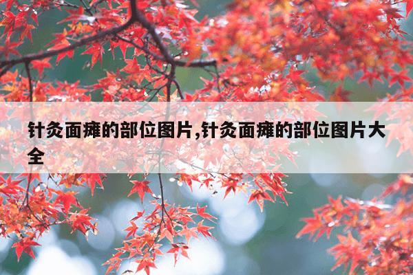 针灸面瘫的部位图片,针灸面瘫的部位图片大全