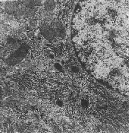 图1-13 初级溶酶体